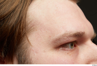 HD Face Skin Robert Watson face forehead skin pores skin…